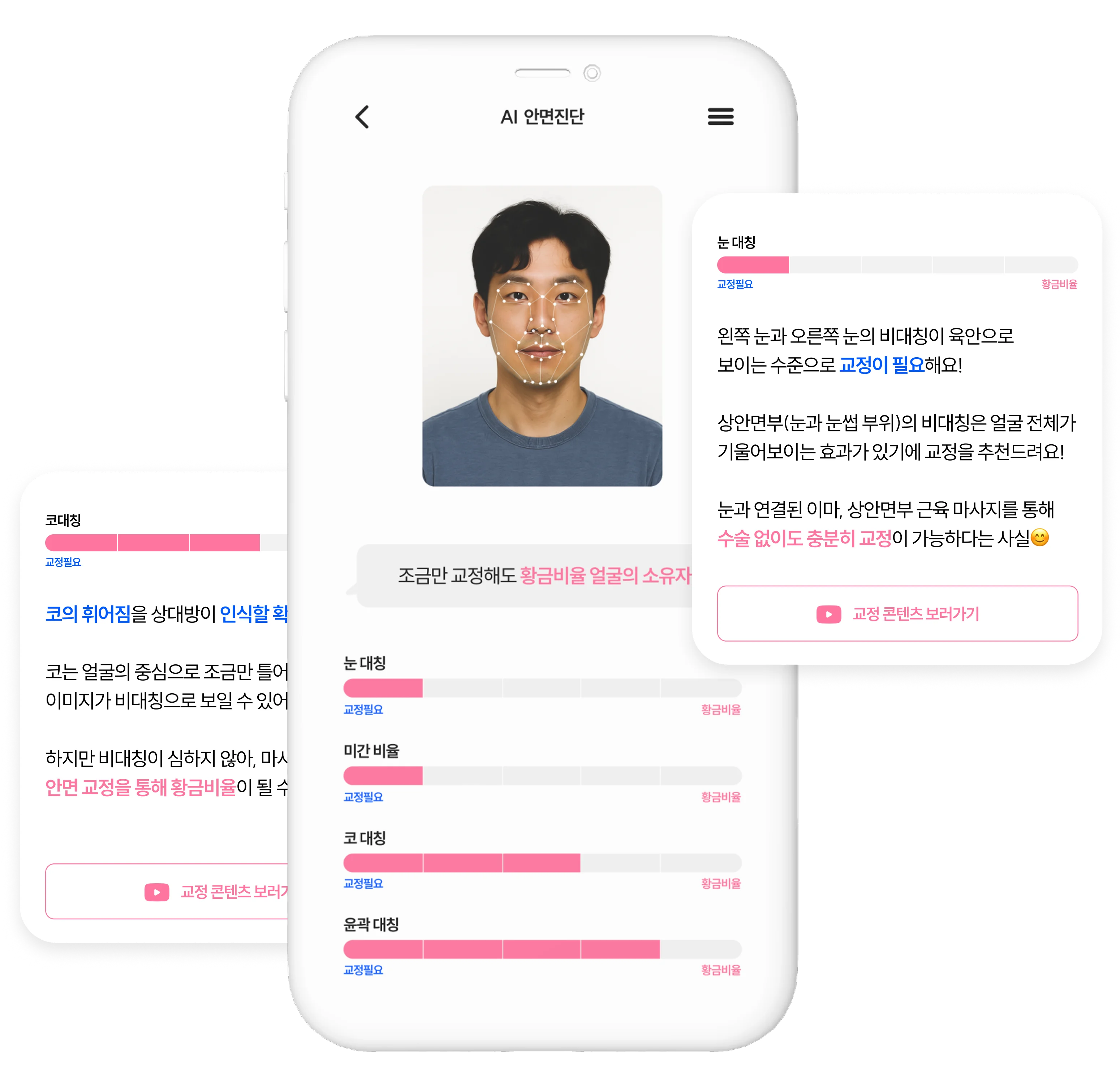 AI 진단 결과 예시